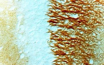 Campo CA 3 dell’ippocampo di un ratto. Terminali assonici positivi per sintaxina su cellule piramidali.