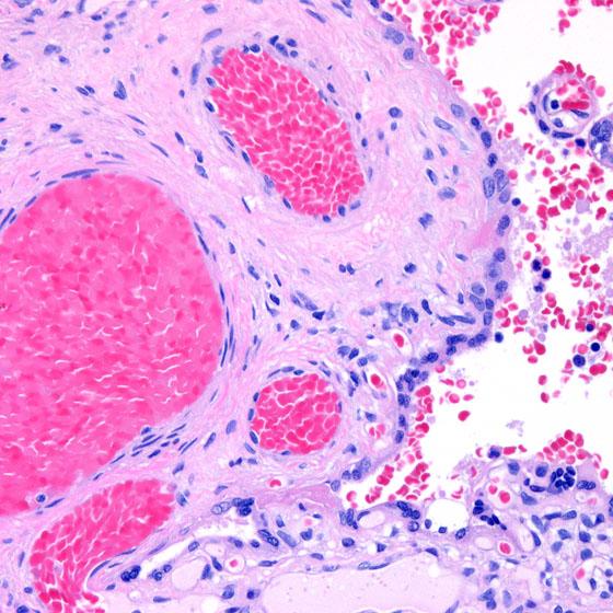 HistoCore SPECTRA H&E stains provide consistent diagnostic stain quality up to 1,600 slides.