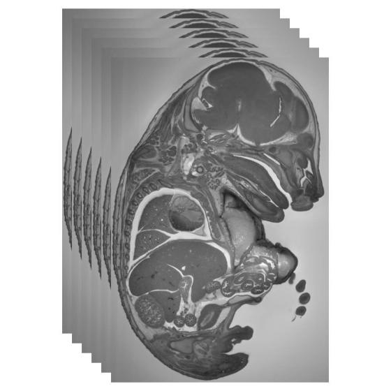 Tecnica di Impilamento per Ricostruzione 3D