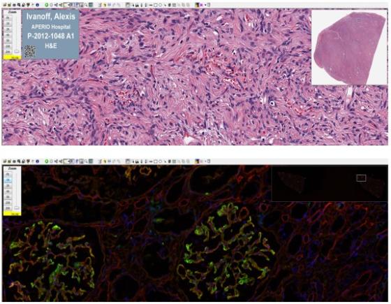 Aperio ImageScope - Software di visualizzazione dei vetrini per patologia