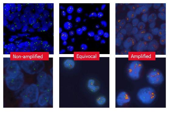 Images of sections stained using the Leica HER2 FISH System