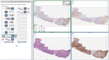 Digitale Pathologie