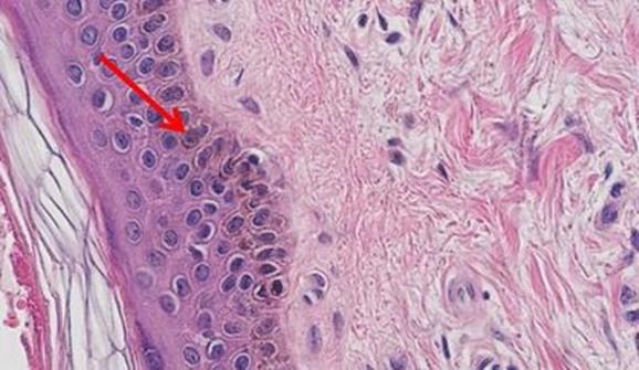 H-and-E-Staining-Overview-A-Guide-to-Best-Practices-img01