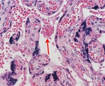 H-and-E-Staining-Overview-A-Guide-to-Best-Practices-img03