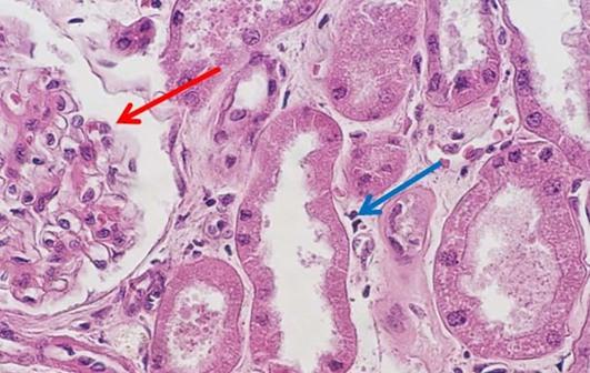 H-and-E-Staining-Overview-A-Guide-to-Best-Practices-img04