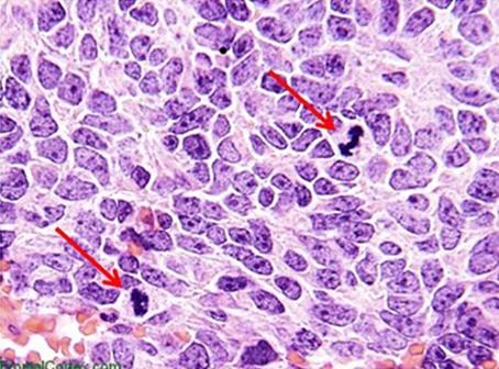 H-and-E-Staining-Overview-A-Guide-to-Best-Practices-img05