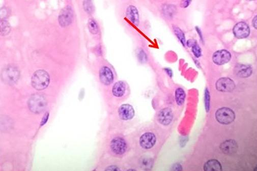 H-and-E-Staining-Overview-A-Guide-to-Best-Practices-img07