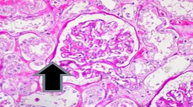 Special Stains – Which One, Why and How? Part I: Mucins and Glycogen