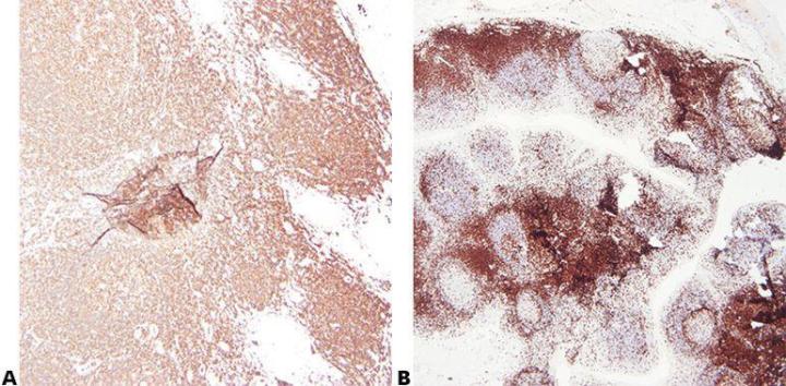 Immunhistochemie: Eine Übersicht + Schritte zu einer besseren IHC-Färbung