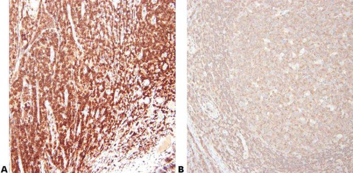 Immunhistochemie: Eine Übersicht + Schritte zu einer besseren IHC-Färbung