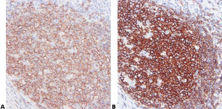 Inmunohistoquímica: Visión general y pasos a seguir para una mejor tinción IHC