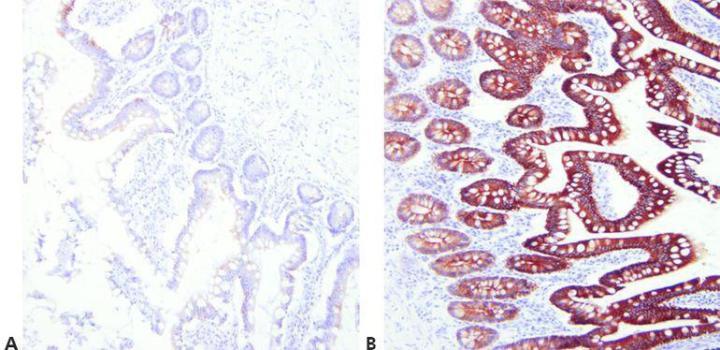 Immunhistochemie: Eine Übersicht + Schritte zu einer besseren IHC-Färbung