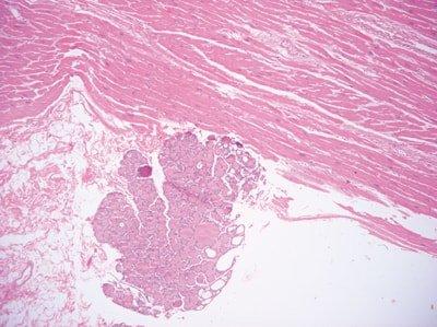 Einführung in die Mikrotomie: Vorbereitung & Schneiden Paraffin-eingebetteter Gewebe