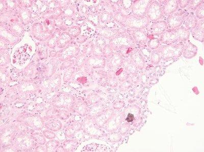 Einführung in die Mikrotomie: Vorbereitung & Schneiden Paraffin-eingebetteter Gewebe