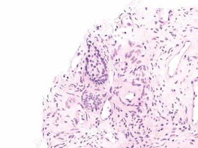 Einführung in die Mikrotomie: Vorbereitung & Schneiden Paraffin-eingebetteter Gewebe