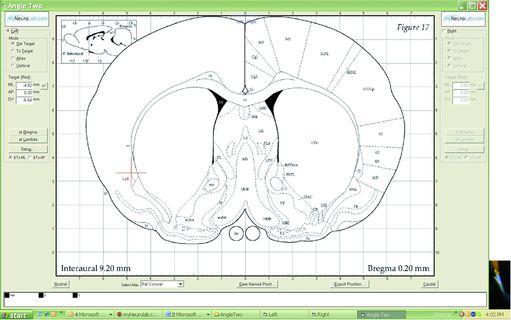 The screen shows, whre the probe tip is above or in the brain as the operator moves it towards the target.