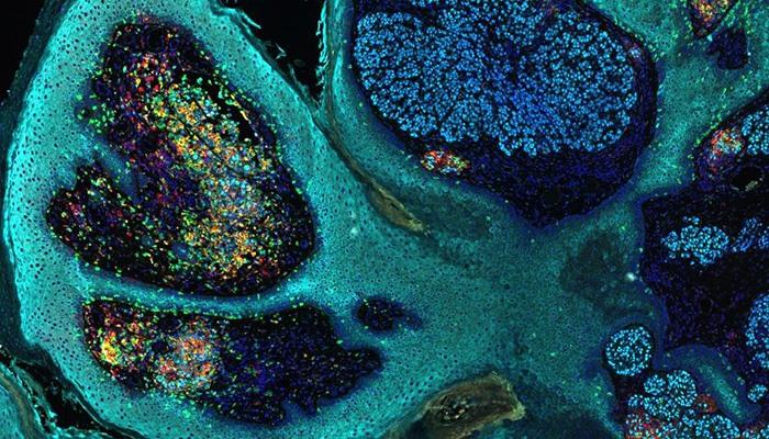 Multiplexing in un solo passaggio, totalmente automatico