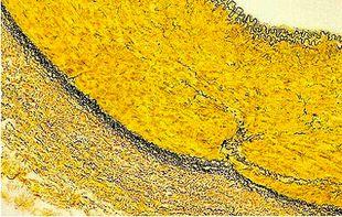 Muscle – Yellow; Elastic Fibers – Black