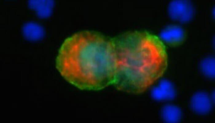 CTC_Analysis_For_Experimental_Pathology_Labs_Partner_Rarecyte