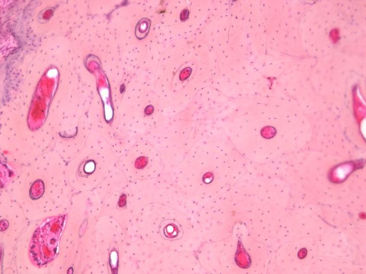 Figure 3: A transverse section from a long bone optimally decalcified using formic acid (H&E). Numerous osteons with peripheral cement lines are shown. Well-stained osteocyte nuclei are present indicating that the decalcification endpoint was not exceeded.