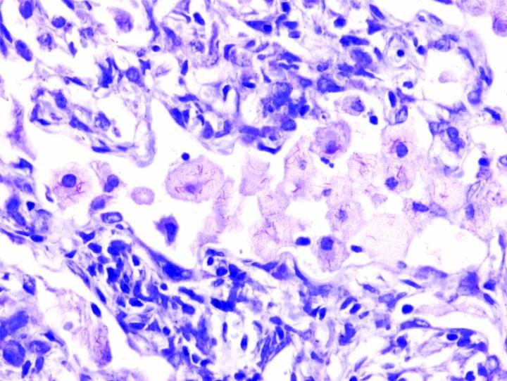 Acid Fast Bacillus stains are used to detect and identify acid fast bacilli in tissue. Bacilli are rod-shaped bacterial organisms. A primary function of this stain is to identify tuberculosis in lung tissue, as well as other bacterial bacillus infected ti