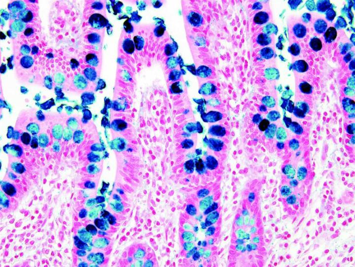 Alcian Blue is normally prepared at an acidic pH of 2.5 and is used to identify acid mucopolysaccharides and acetic mucins. Excessive amounts of non-sulfated acidic mucosubstances are seen in mesotheliomas, certain amounts occur normally in blood vessel w