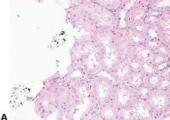 Einführung in die Mikrotomie: Vorbereitung & Schneiden Paraffin-eingebetteter Gewebe