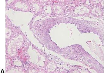 Einführung in die Mikrotomie: Vorbereitung & Schneiden Paraffin-eingebetteter Gewebe