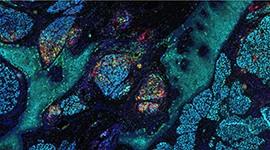 Multiplex fluorescence immunohistochemistry using the Ultivue InSituPlex platform on the Leica Biosystems BOND RX