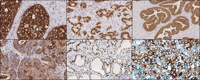 IHC-protein-expression-profile