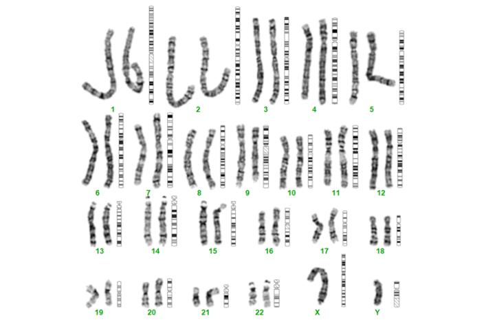 Reduce time to results and improve the consistency of your Cytogenomic analysis