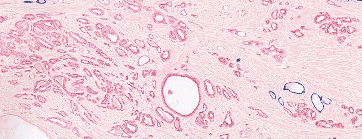 Multiplex Staining 3-Plex