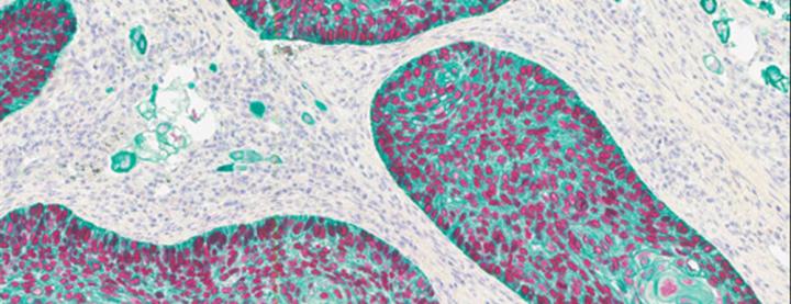 Multiples Staining 2-Plex