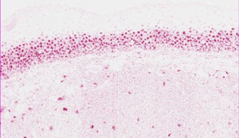 Cyclin-D1-red-nuclear-stain