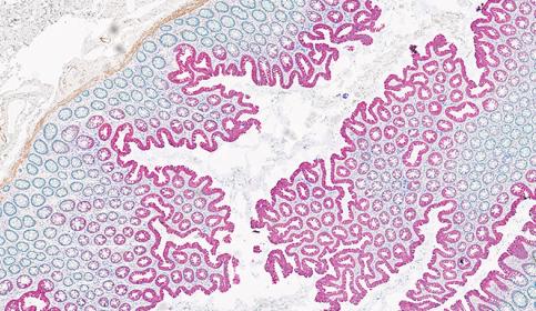 Multiplex Staining 4-Plex