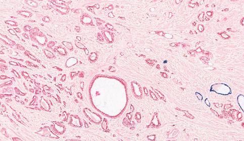 Multiplex Staining 3-Plex