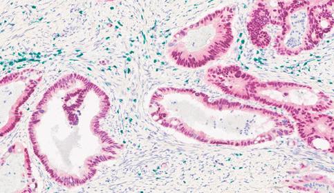 Multiplex Staining 2-Plex