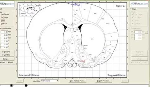 approach-angle-in-stereotaxic-surgery-640x410