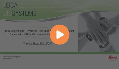 from-diagnosis-to-treatment-part-3-of-4-diagnosis-of-breast-cancer-with-he-and-immunohistochemistry-stains-640x410