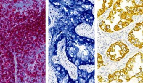 Chromogens-and-IHC-Reagents-640x410